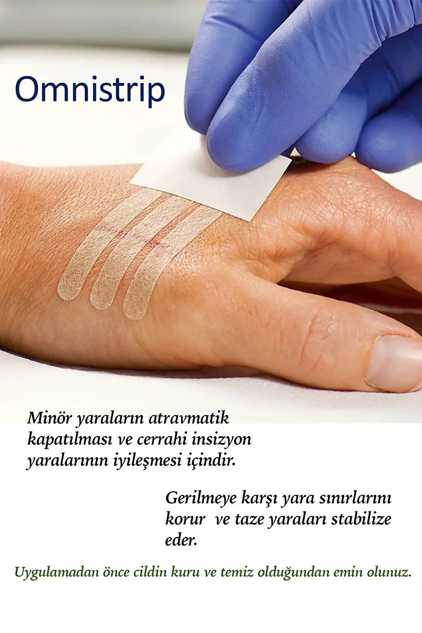 Dikiş Bantlarıyla Dekorasyon ve Pratik Çözümler: Yaratıcı ve Kullanışlı Uygulamalar