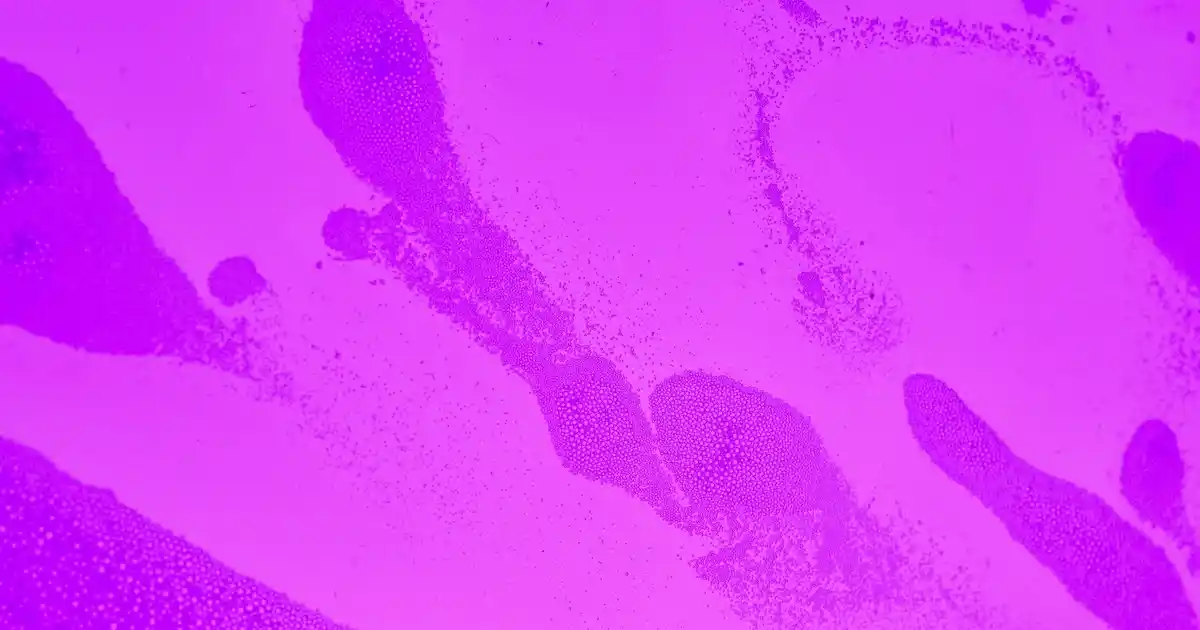 Iğne Oyası Seccade Takımı: Geleneksel El Sanatlarıyla Modern Dekorasyonun Buluşması