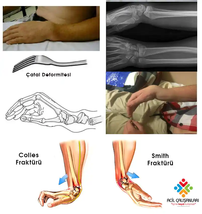 Kırık Çatal Dekorasyonuyla Yaratıcı ve Şık Mekan Tasarımları Rehberi