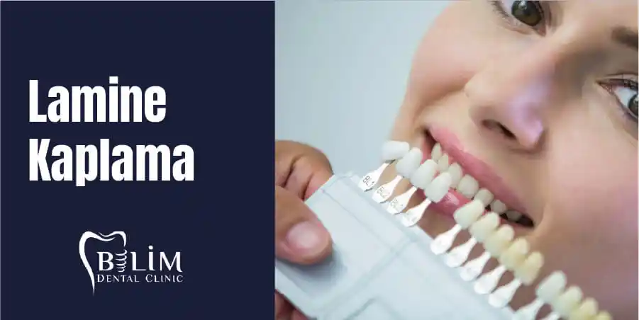 Lamine Kaplama Nedir ve Dekorasyonda Nasıl Uygulanır Detaylı Rehber